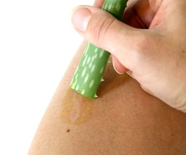 antibacterial aloe vera applied to an open wound